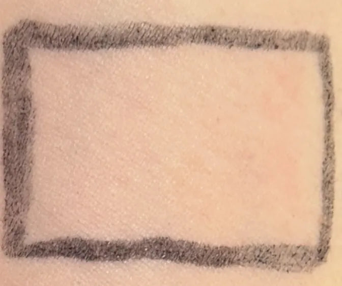 Arm with REYS — visibly less redness one hour after taking REYS